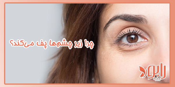 چرا زیر چشم‌ها پف می‌کند؟